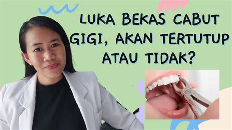 erek erek cabut gigi