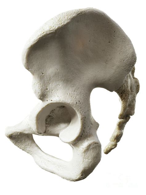 Hip Bone Photograph By Sebastian Kaulitzkiscience Photo Library Pixels