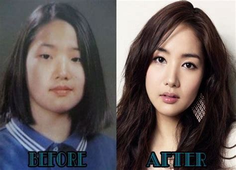 Korean Actress Plastic Surgery All In One Photos