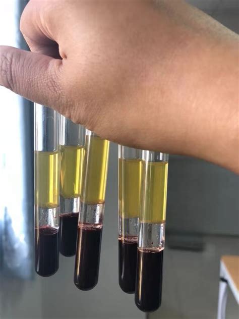 Transparent Serum Separator Tube Gel Medical Additives For Blood