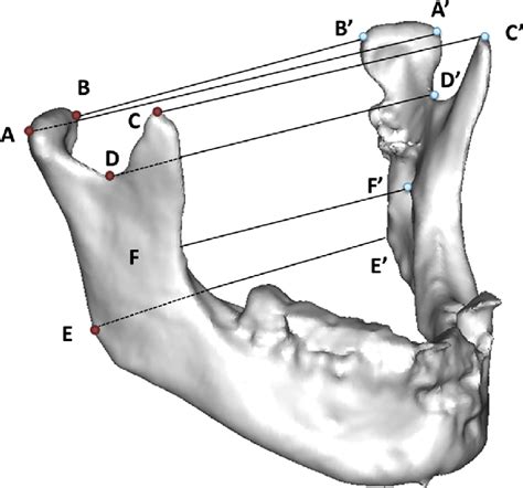 Landmarks A Lateral Pole Of The Condyle B Medial Pole Of The