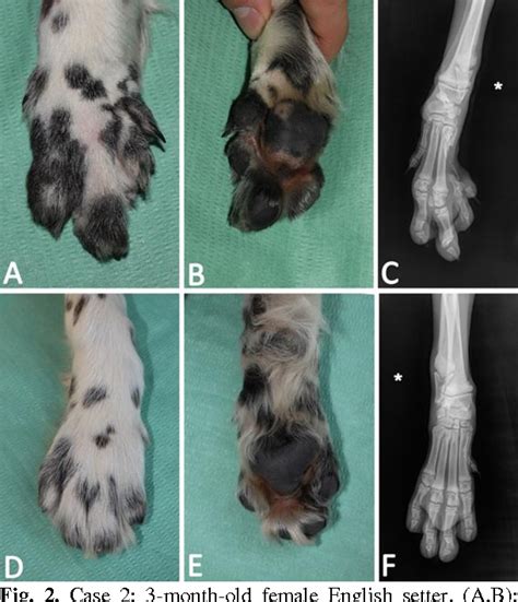 Figure 1 From Congenital Deformity Of The Distal Extremities In Three