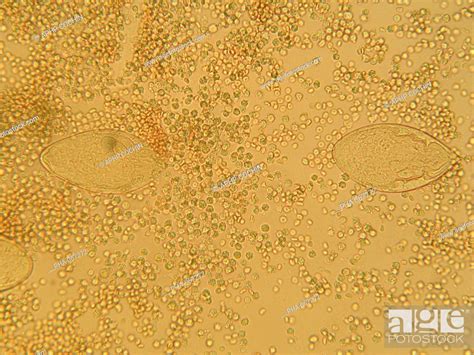 Urine Light Micrograph Of Schistosoma Haematobium Trematode Worm