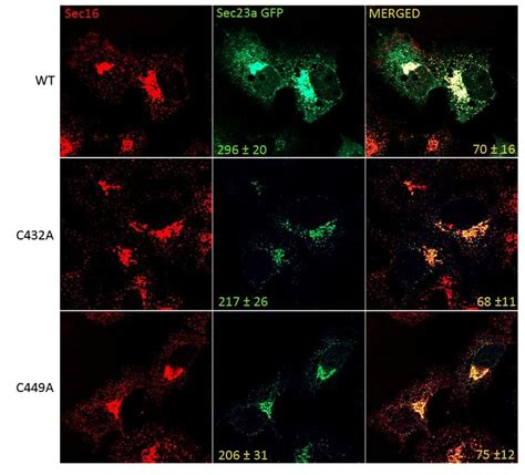 Sec23a Ubiquitylation Affects Copii Vesicles Formation Huh7 Cells