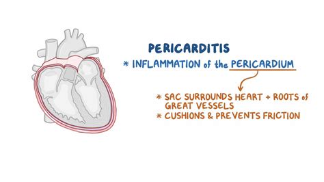 Pericarditis Nursing Osmosis Video Library