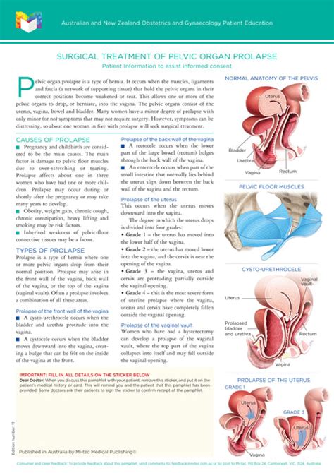 Surgical Treatment Of Pelvic Organ Prolapse Mi Tec Medical Publishing