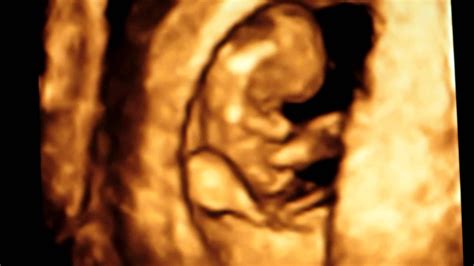 Ultrasound At 8 Weeks 2 Days Youtube