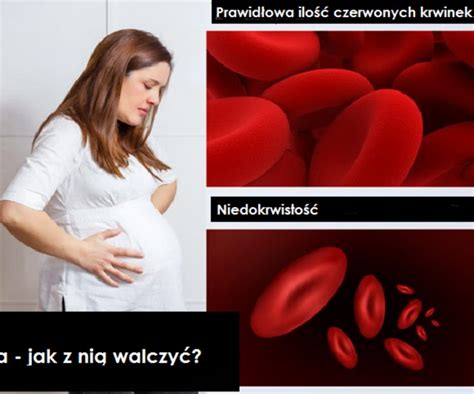 anemia objawy przyczyny anemia w ciąży leczenie zdrowie My XXX Hot Girl