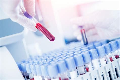 Study Says Blood Test Can Predict Leukemia Risk Gadgetonus