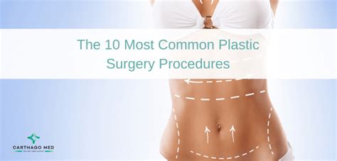 Most Popular Plastic Surgery Procedures