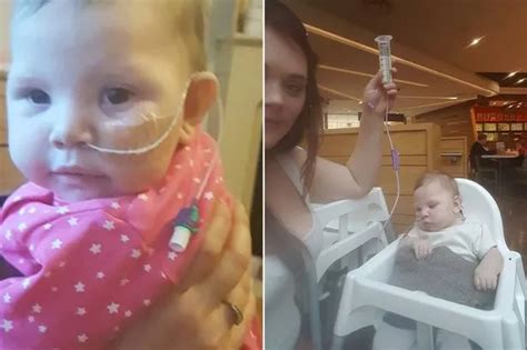 Brave Mum Battling Extreme Bubble Like Skin Condition That Leaves Her