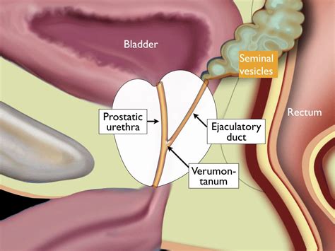 Prostate Anatomy Images Anatomical Charts And Posters