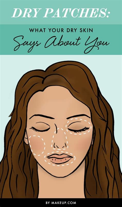 Dry Patches — What Your Dry Skin Says About You With Images Dry