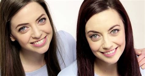 These Girls May Be The Worlds Most Unusual Identical Twins Favrify