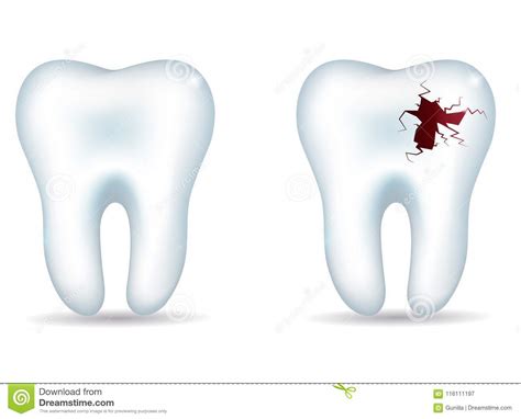 Healthy Tooth And Unhealthy Tooth Stock Vector Illustration Of