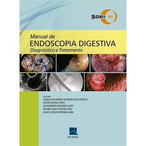 Manual De Endoscopia Digestiva Sobed Rs Diagn E Tratamento Livraria Odontomedi