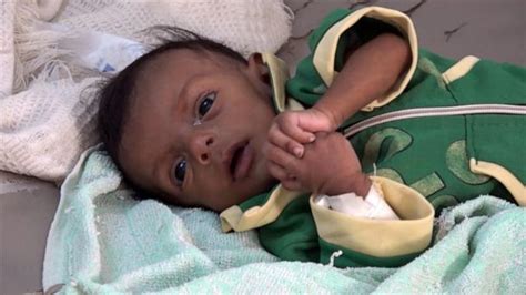 video yemen on the brink of starvation abc news