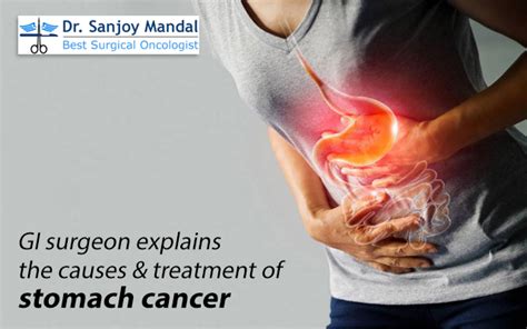 GI Surgeon Explains The Causes Treatment Of Stomach Cancer