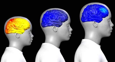 Uncovering The Secrets Of The Adolescent Brain