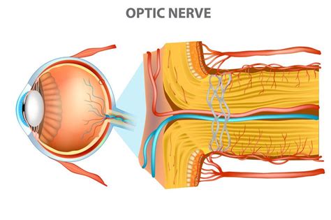 Optic Nerve Swelling Papilledema Guide Causes Symptoms And Treatment Options