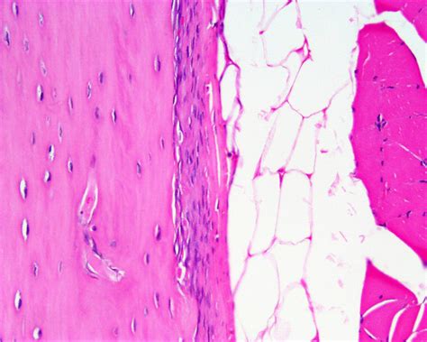 Filopodia from adjacent osteocytes communicate via gap junctions. File:Bone histology 021.jpg - Embryology
