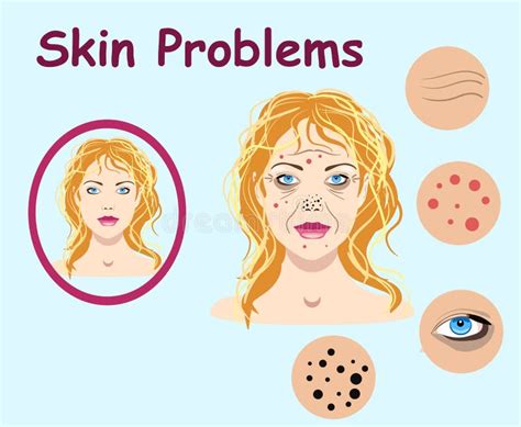 Female Face Skin Problems Vector Illustration For Cosmetic Stock