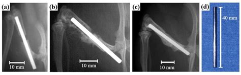 Metals Free Full Text Application Of Zr And Ti Based Bulk Metallic Glasses For Orthopaedic