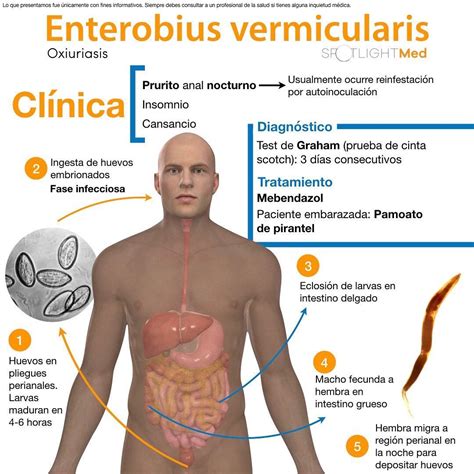 La Enterobiasis Sintomas Enterobius Vermicularis Sintomas Y Prevencion