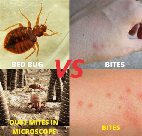 Drain Pop Physics Dust Mite Bites Vs Bed Bugs Sister Absolute Photography
