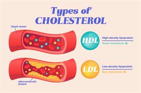 3 Things You Should Know About Cholesterol Levels In Your Body