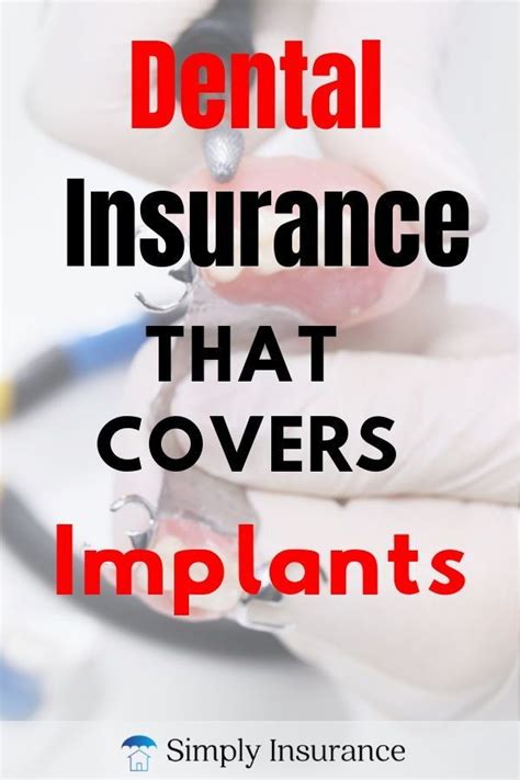 Collision coverage pays to repair your own car's damage when you hit another vehicle or an. Dental Insurance That Covers Implants. You might think you ...