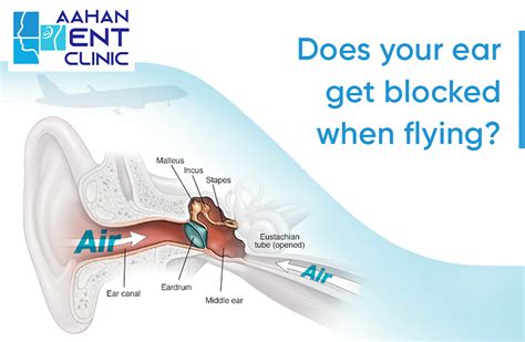 Does Your Ear Get Blocked When Flying Aahan Ent Clinic Drajay