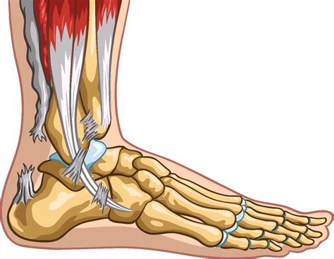 10 Symptoms Of Achilles Tendon Injury Facty Health