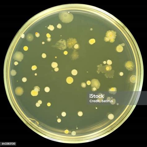 Bacterial Colonies On Agar Plate Isolated On Black Stock Photo
