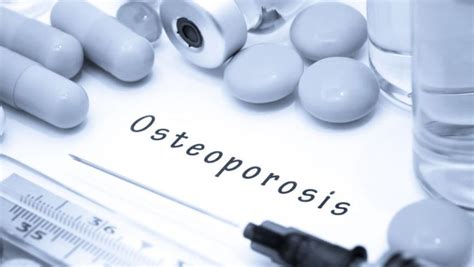 Big Advances For Two Osteoporosis Drugs Rheumnow