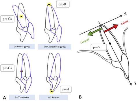 A Cone Beam Computed Tomographic Study Evaluating The Efficacy Of