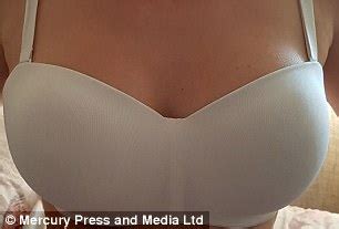 Katy Jones Has Square Breasts After Botched Surgery Daily Mail Online