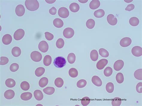 Red Blood Cell Indices Colour And Size A Laboratory Guide To