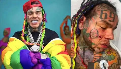 Rapper Tekashi Ix Ine Rushed To The Hospital After Being Savagely