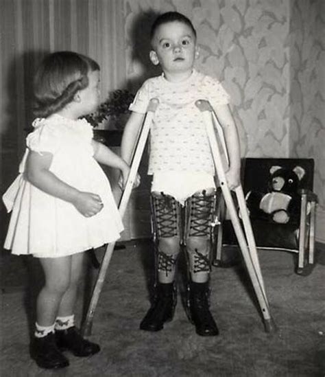 Pin By Dianne Dych On Polio 3 Leg Braces Beautiful People Polio