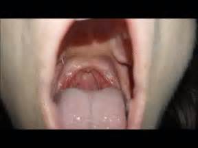 Yawning And Coughing Uvula Go Ask Alandra Clips Sale