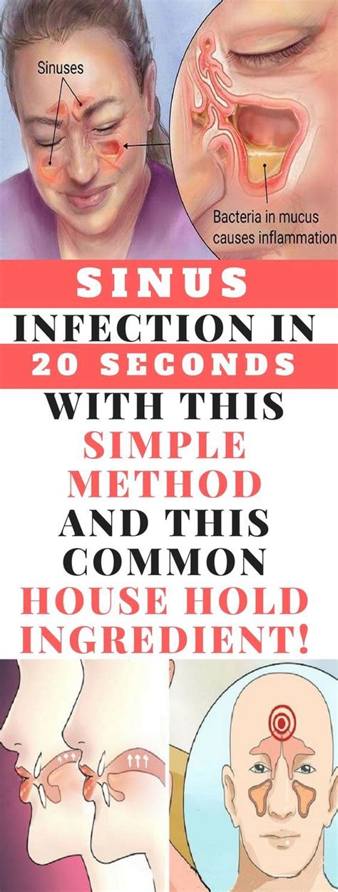 Get Rid Of Sinus Infection In 20 Seconds With This Simple Method And