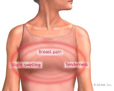 The New York Times Health Image Breast Pain