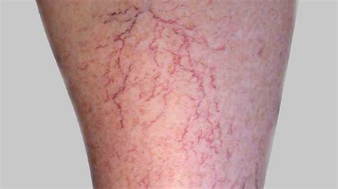 When To Worry About A Rash In Adults Healthella Page 13