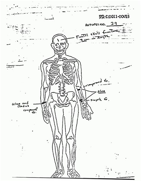 Jeffrey Macdonald Case Justthefacts Colette Macdonald Death And Autopsy