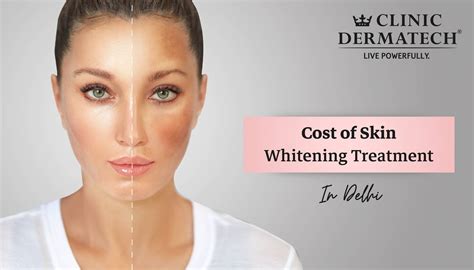 Cost Of Skin Whitening Treatment In Delhi Clinic Dermatech