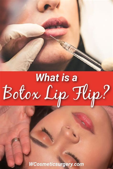 What Is A Botox Lip Flip In 2023 Botox Lips Botox Botox Under Eyes