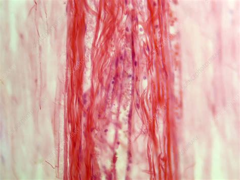 Sciatic Nerve Of Cat Lm Stock Image C0093491 Science Photo Library