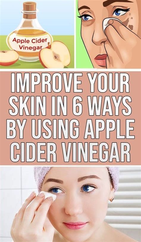 Improve Your Skin In 6 Ways By Using Apple Cider Vinegar Modern Apple Cider Vinegar Uses