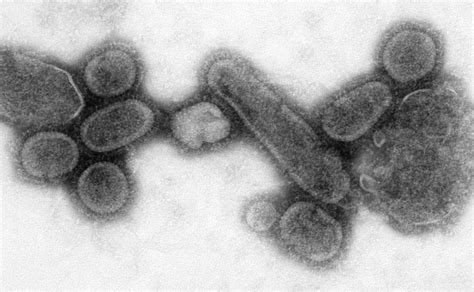 Electron Micrograph Of Influenza Virions Biology Of Human World